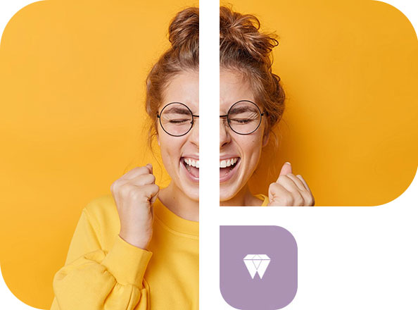 Sbiancamento dei Denti